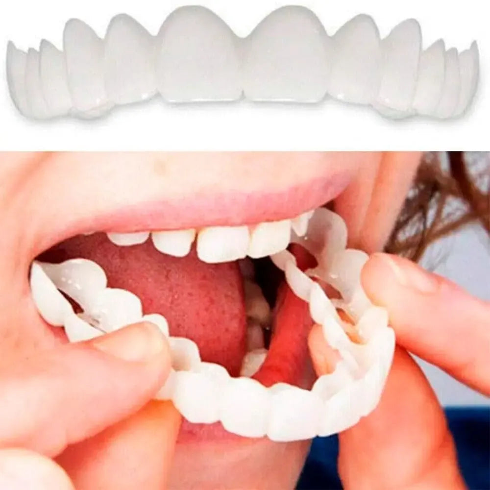 Lente Dental White
Snap On Smile
newsmile
dentadura universal newsmile
dentadura de silicone
dentadura universal
dentaduras removiveis
